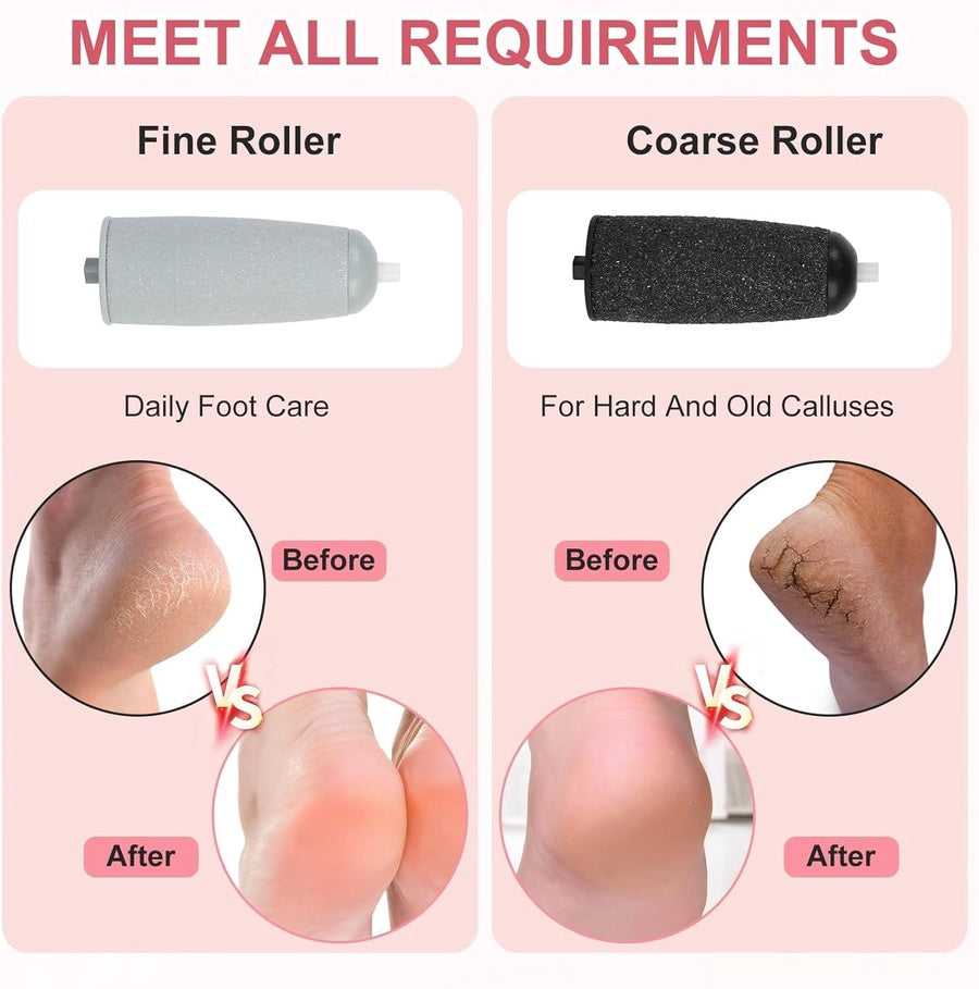 مقشر القدمين الكهربائي